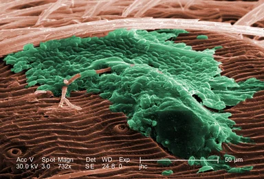Free Stock Photo: Scanning electron micrograph of a brown recluse spider.