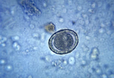 Free Stock Photo: Micrograph of a fertilized round worm egg.