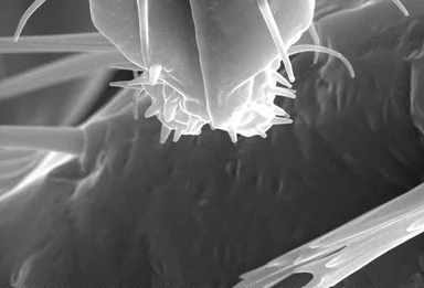 Free Stock Photo: Microscopic bedbug scanning electron micrograph.